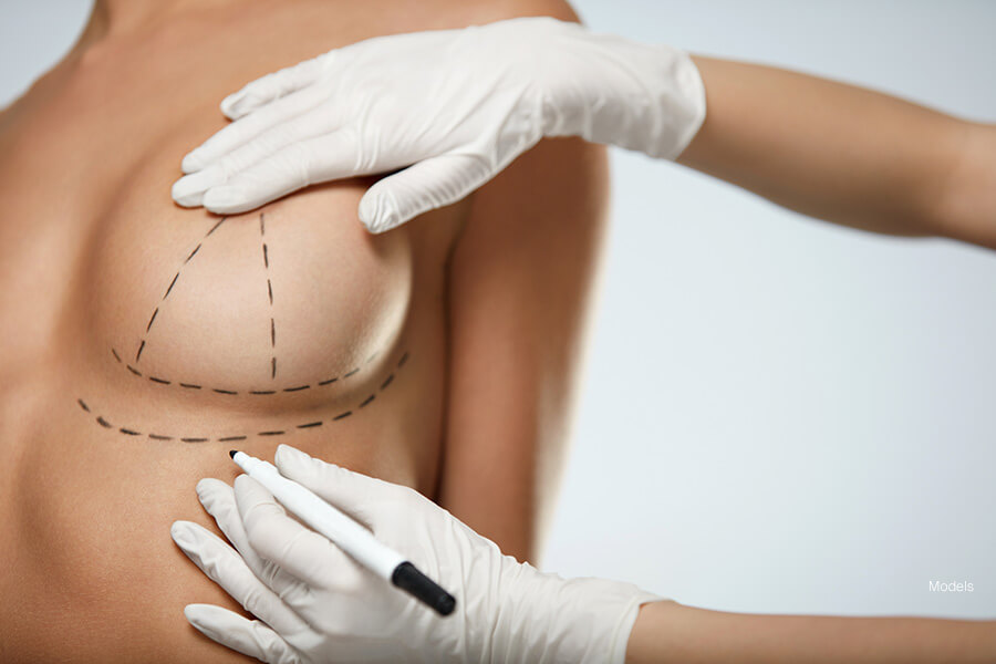 Cosmetic Breast Surgery